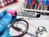 VARIOLE SINGE importé Chine