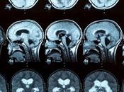 TRAUMA CRÂNIEN DÉMENCE liquide céphalo-rachidien fait lien