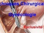 Techniques Chirurgicales Gynécologie