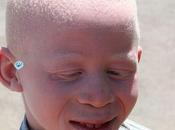 Kivu chasse albinos poursuit.