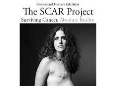 scar project cancer sein n’est ruban rose