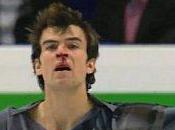 Eric Radford casse patinage artistique