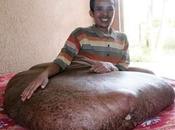 vietnamien avec tumeur kilos