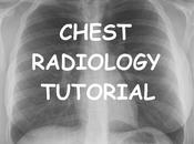 Radiographie Thoracique pour Nuls Chest X-ray Made easy