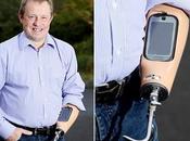 dock dans prothèse d’avant-bras