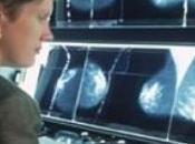 CANCER SEIN: Faut-il repenser dépistage? demande British Medical Journal