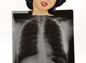 Matthew X-rays