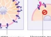 CANCER SEIN: injection d’Herceptin aussi efficace qu’une chimio Conférence européenne cancer sein (EBCC-8)