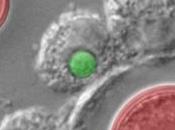 CRYPTOCOCCOSE VIH: Cibler cellules titan protègent Cryptococcus Eukaryotic Cell