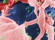 VIH: scientifiques identifient nouvelle protéine inhibe virus PNAS-NIH