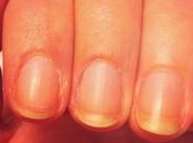 dissous cuticules fais ongles forts