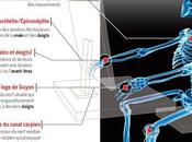 cou, première victime bureau Blogeur
