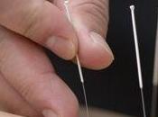 L'acupuncture soulage petits maux grossesse