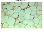 Nouvelle recherche: cellules gras créent l'inflammation