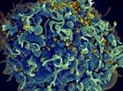 VIH: Traitement précoce contrôle, clés d'une guérison fonctionnelle? PLoS