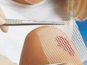 PLAIES: Découverte nouvelles enzymes favorisent cicatrisation Genetics Society America