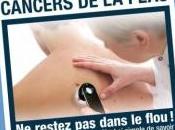 Prévention CANCERS PEAU: mai, montrez votre peau! SNDV