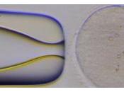 DONS d'OVULES: Mais quelles sont motivations donneuses? ESHRE