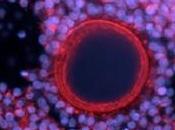 CORONAVIRUS MERS-CoV n'est urgence santé publique
