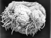 "parasitisme" économique