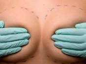 brésilienne veut battre record monde plus gros implants mammaires
