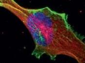 CANCER: cellules cancéreuses savent bien elles vont