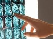 NEURO: coin cerveau reste jeune malgré l'âge International Cognitive Neuroscience Conference
