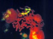 #tumorigenèse #autophagie #anoïkis Fonctions cellulaires métaboliques liées l’autophagie dans cellules cancéreuses