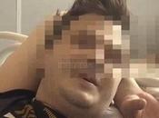 homme fait amputer testicules pendant sommeil (Russie)