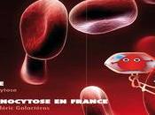 DREPANOCYTOSE MALAISE FRANÇAIS L’évolution dépistage néonatal