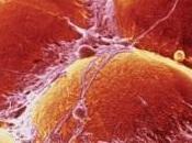 OBÉSITÉ: cellules graisse interrupteur métabolique NEJM