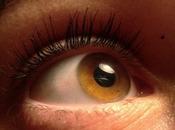 L’oeil organe trop souvent malmené
