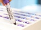 CRISE CARDIAQUE: test sanguin écarte risque Urgences Lancet
