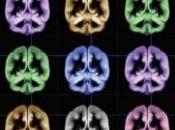 CERVEAU: recherche bonheur Scientific Reports