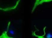 CELLULES SOUCHES: pacemaker biologique pour remplacer l'électronique? Trends Molecular Medicine