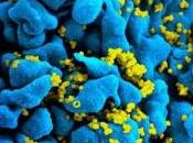 VIH: Pourquoi dans certains cas, rapports sexuels risque réduisent Mucosal Immunology