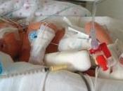 PRÉMATURITÉ: Kangourou peau pour donner toutes chances bébé Pediatrics