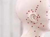 FIBROMYALGIE: L'acupuncture fait preuves contre douleur Journal NeuroImage