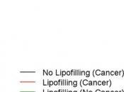 RECONSTRUCTION MAMMAIRE: L'injection graisse n'augmente risque cancer Plastic Reconstructive Surgery