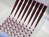 CANCER SEIN: indices épigénétiques déjà présents dans tissu sain Nature Communications