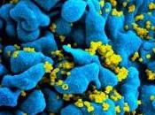 VIH: Coincer virus dans tractus génital féminin Journal Clinical Investigation