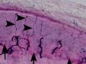 FIBROMYALGIE: hypersensibilité centrale petites fibres nerveuses? Pain Current Headache Reports