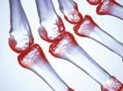 RHUMATISMES: l'on buvait vert? Arthritis Rheumatology