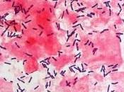 MICROBIOTE VAGINAL VIH: lactobacillus pour neutraliser virus AIDS Research Human Retroviruses