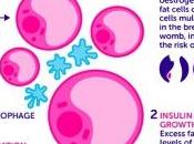 OBÉSITÉ: grandes voies peuvent mener cancer Cancer Research