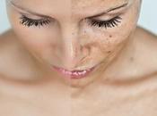 bronzage cancer peau