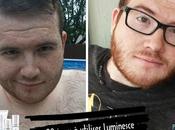 peau jamais aussi radieuse grace Jeunesse *Témoignage Simon