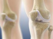 ARTHROSE: hydrogel intelligent pour régénérer cartilage abîmé Santé Orthopédique