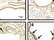 GRIPPE CONTRACEPTION: pilule évite conception, grippe! PLoS Pathogens