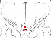 point vaisseau conception (2VC)